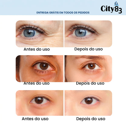 ✨ LumiEyes™ Óculos de Cuidado Ocular [Adeus Olheiras e Bolsas em 10 Minutos]