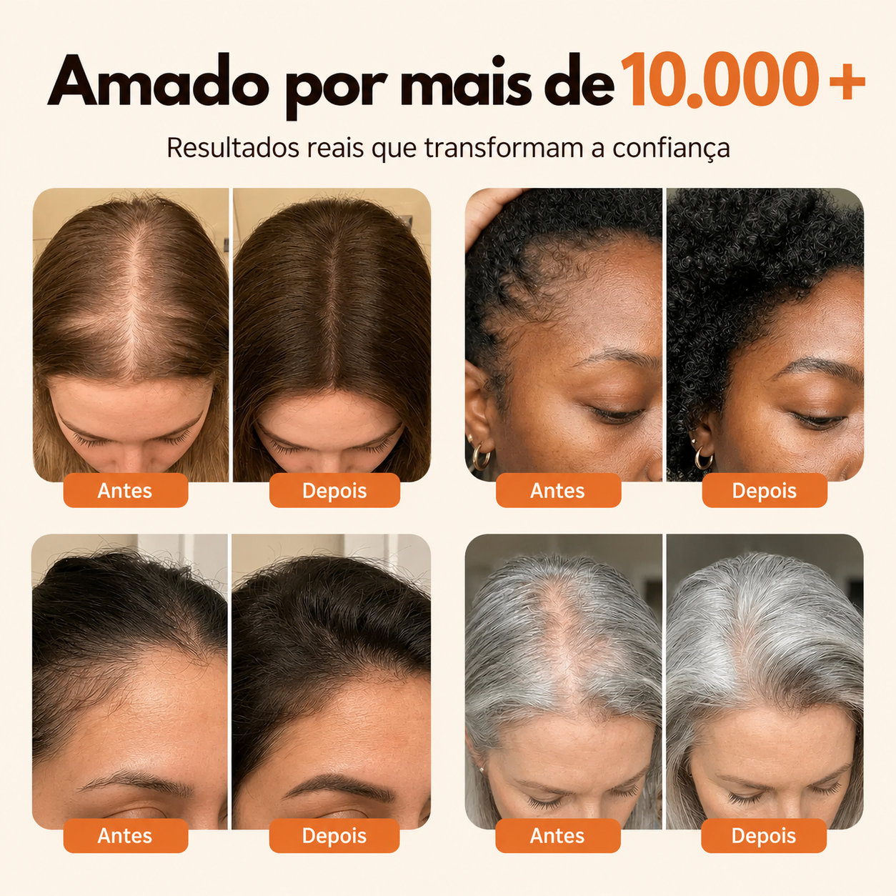 ✨ ScalpBloom™ Ampola de Ativação Capilar [Ritual Coreano Anti-Queda]