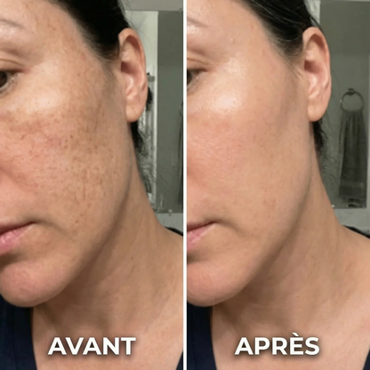 LuxLift™ Dispositivo Facial 6 em 1 [Lifting Natural Sem Agulhas]