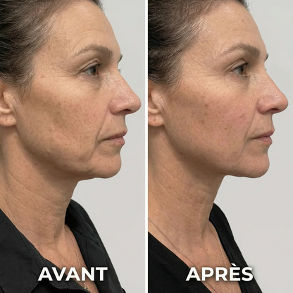 LuxLift™ Dispositivo Facial 6 em 1 [Lifting Natural Sem Agulhas]