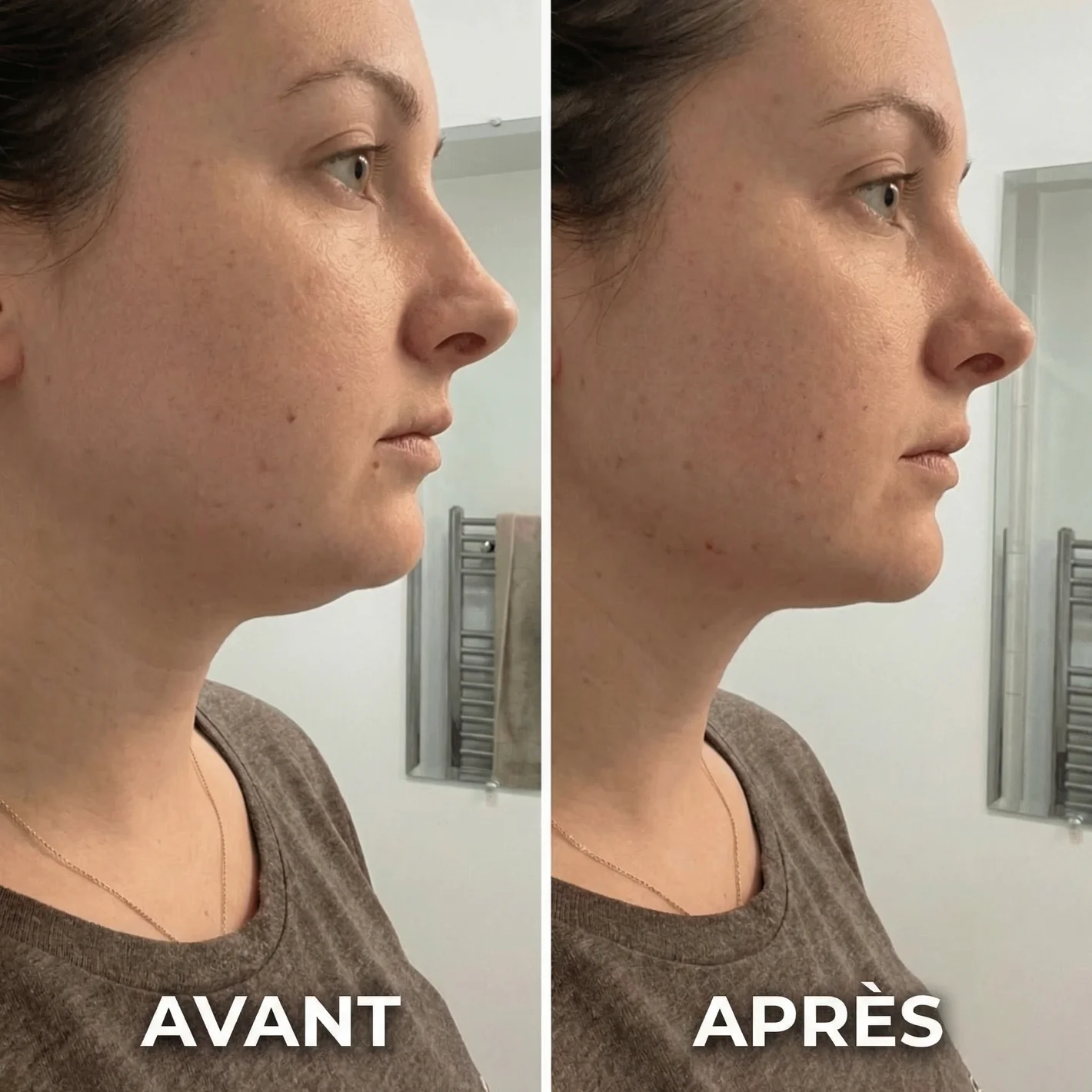 LuxLift™ Dispositivo Facial 6 em 1 [Lifting Natural Sem Agulhas]