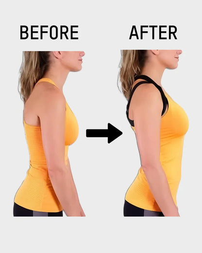 ShapeBack™ Sutiã Corretor de Postura [Postura Perfeita Sem Parecer Que Está de Sutiã]