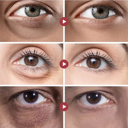 ✨ EyeGlow™ O Autêntico Sérum Coreano [Iluminador de Olheiras]