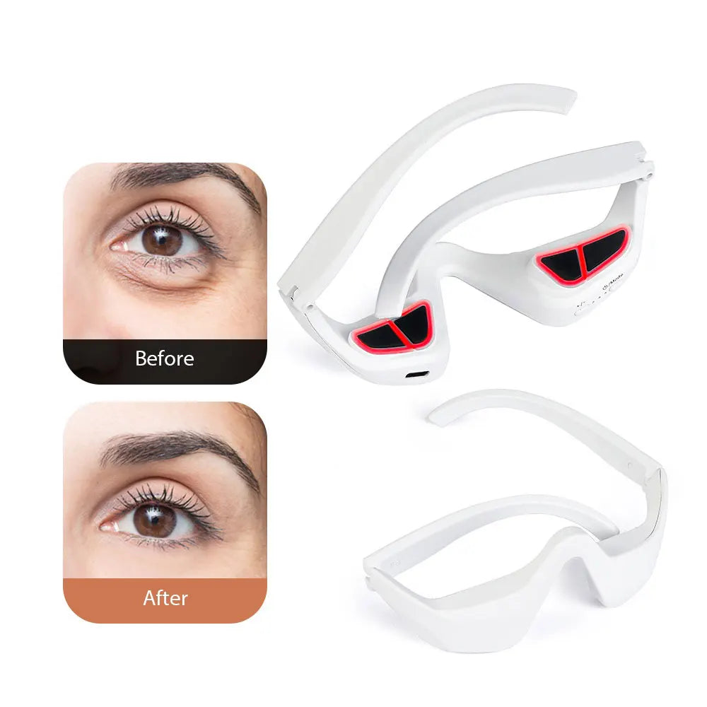 ✨ LumiEyes™ Óculos de Cuidado Ocular [Adeus Olheiras e Bolsas em 10 Minutos]